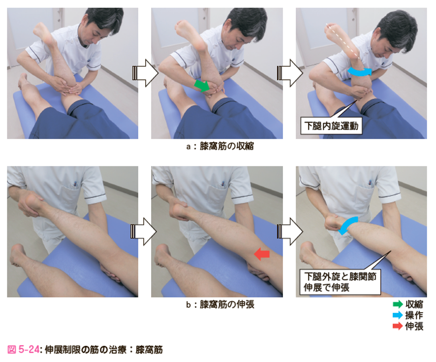 膝関節拘縮の評価と運動療法 運動と医学の出版社
