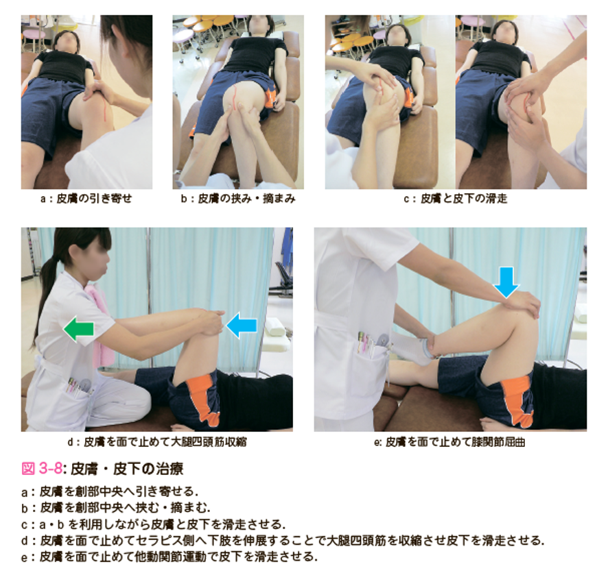 膝関節拘縮の評価と運動療法 運動と医学の出版社