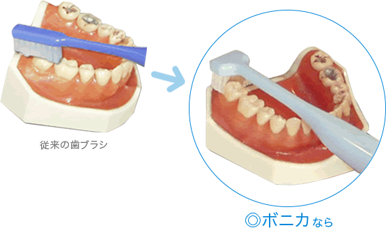 T字型歯ブラシの紹介