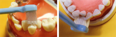 臼歯 外側の磨き方