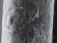 リセーブル顕微鏡写真